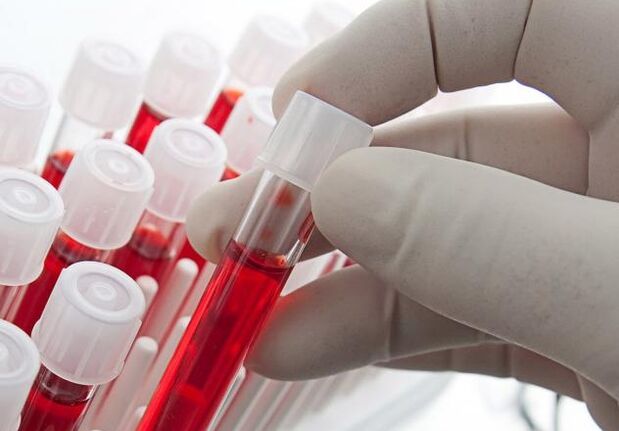 анализ крови после приема алкоголя